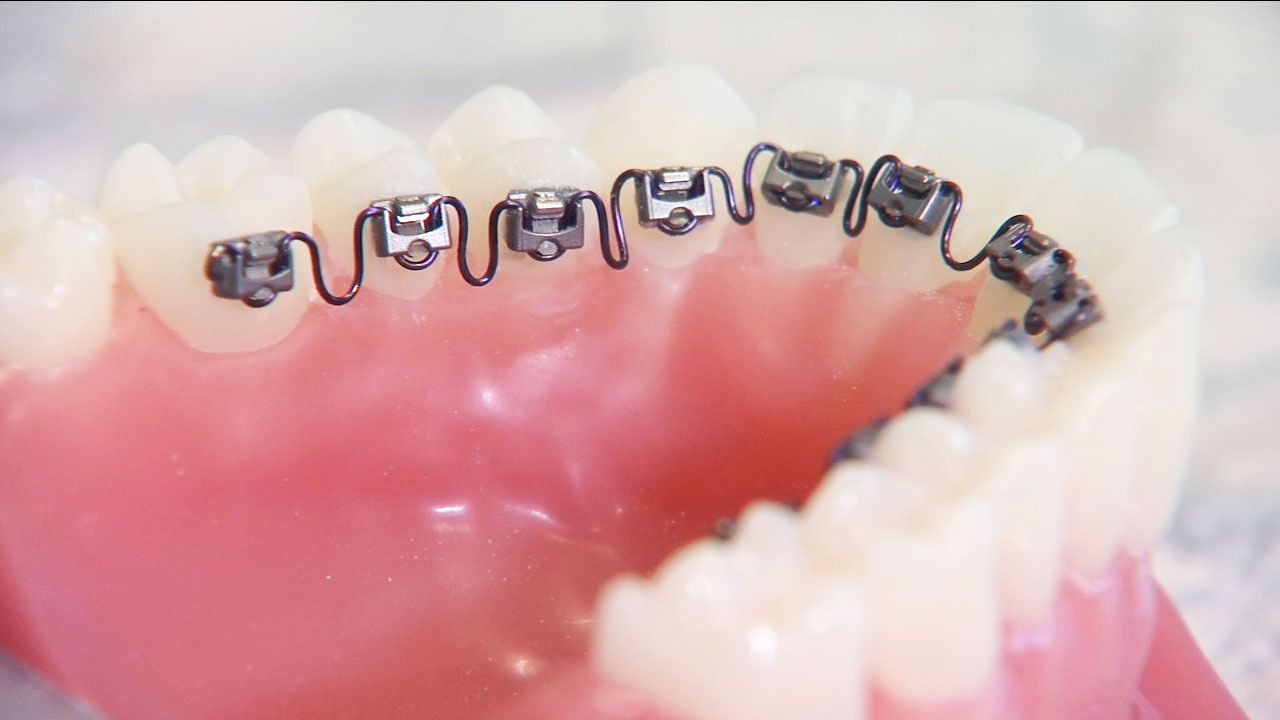 San Antonio Orthodontics