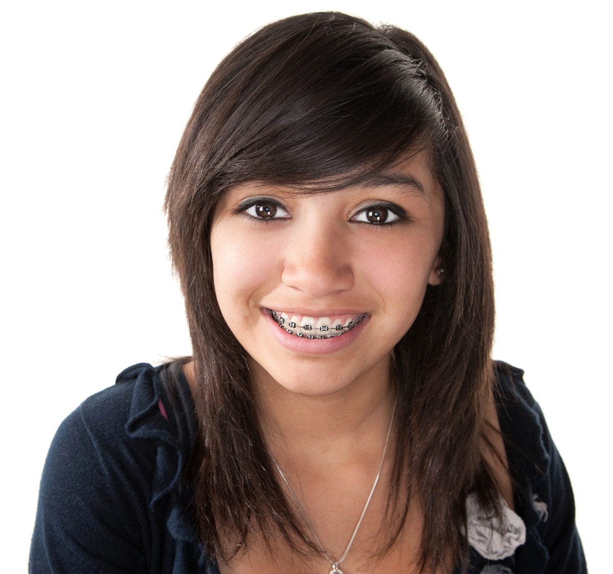 Grin Dental Monitoring