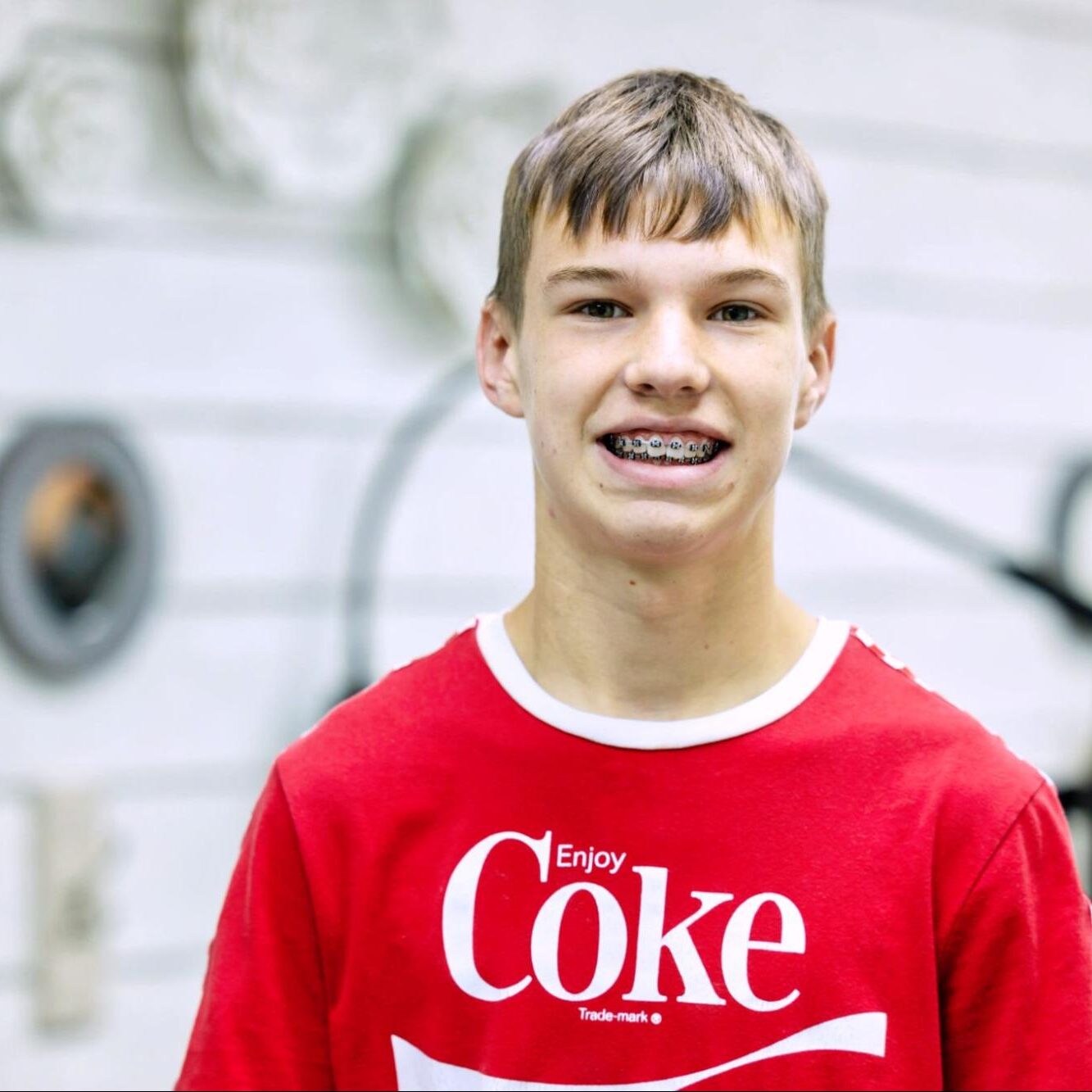 How Do Oral Hygiene Practices Differ for Braces and Invisalign Users?